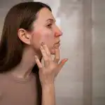 Woman checking her skin for rosacea – dermatology care for sensitive skin in Dubai