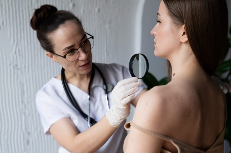 Skin Cancer Awareness: Prevention and Early Detection