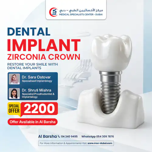 DENTAL IMPLANTS